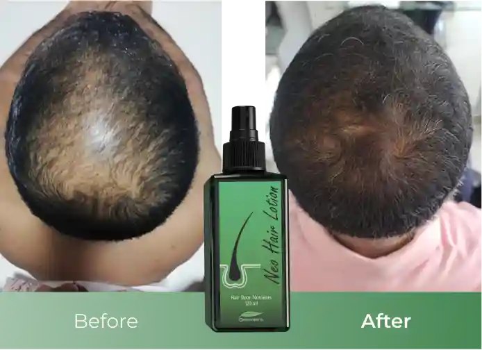 Result photo shared by Varun Das
