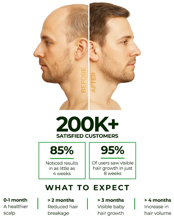 Neo Hair Lotion by Green Wealth — botanical hair growth spray